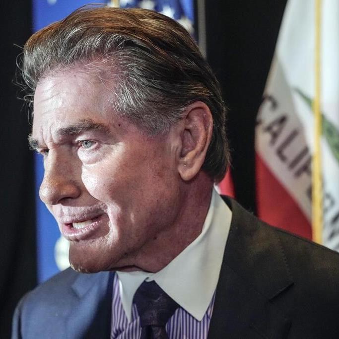 AP Decision Notes: What to expect in California on Election Day